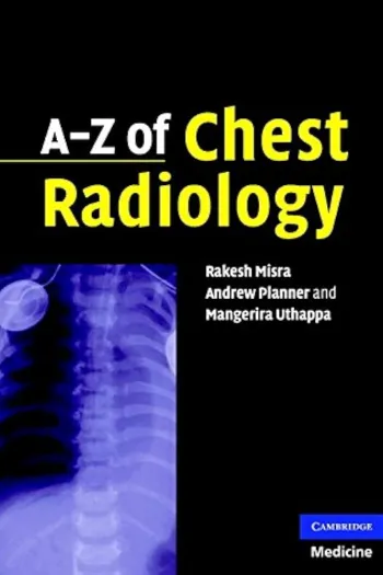A–Z of Chest Radiology A–Z of Chest Radiology
